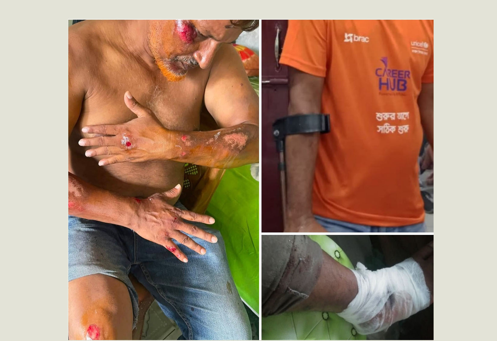 নকলায় ২ দিনের ব্যবধানে সড়ক দুর্ঘটনায় ২ সাংবাদিক নেতা গুরুতর আহত!