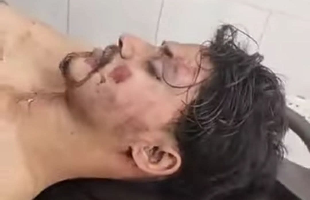 বাঞ্ছারামপুরে আধিপত্য বিস্তার নিয়ে সংঘর্ষে নিহত ১, আহত ২৫
